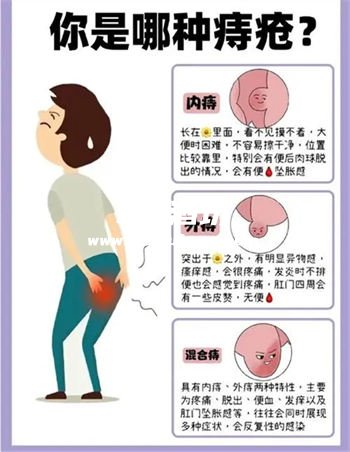 香菜白酒可以治疗痔疮吗