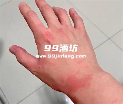 白酒可以用来洗脸吗?人久久带您了解 白酒可以用来洗脸吗?人久久带您了解