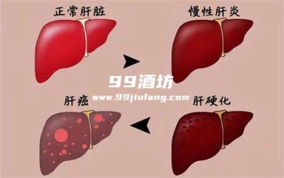 每天一两白酒养生?最新医学研究颠覆传统认知