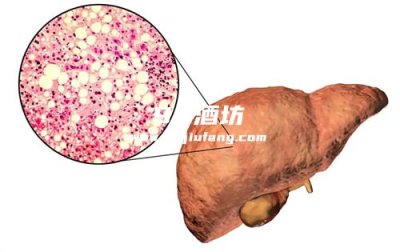 白酒和啤酒哪个更伤肝?